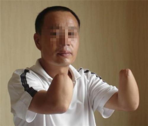 河南男子举报村霸，被报复砍去双手成残疾，2008年主犯被判死刑